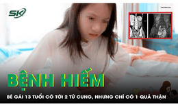 Hiếm gặp: Bé gái 13 tuổi chỉ có một quả thận, 2 tử cung