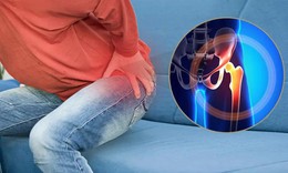 Bài tập cho người bệnh thoái hóa khớp háng