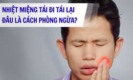 Nhiệt miệng t&#225;i lại thường xuy&#234;n, l&#224;m thế n&#224;o để ngăn ngừa?