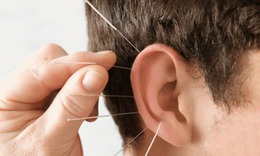 Câu hỏi thường gặp liên quan đến mất thính lực