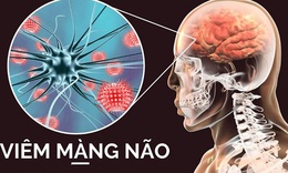 Những c&#226;u hỏi li&#234;n quan bệnh vi&#234;m m&#224;ng n&#227;o mủ