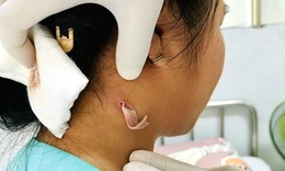 Đồng Nai ghi nhận bệnh nhi đầu tiên nhiễm vi khuẩn gây bệnh Whitmore