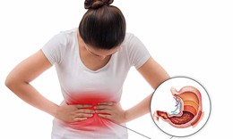 Polyp dạ d&#224;y c&#243; nguy cơ ung thư kh&#244;ng?