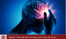 Cảnh gi&#225;c với dị dạng mạch m&#225;u n&#227;o