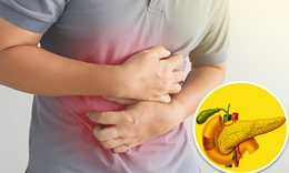 Cẩn trọng viêm tuỵ cấp do ăn nhiều chất béo, bia rượu, lười vận động