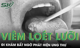 Vi&#234;m lo&#233;t, đau r&#225;t lưỡi hơn một th&#225;ng đi kh&#225;m ph&#225;t hiện ung thư lưỡi 