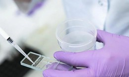 3 chiến lược bảo tồn khả năng sinh sản cho người nhiễm HIV