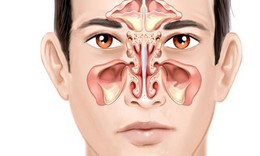 Bệnh viêm đa xoang có nguy hiểm không?
