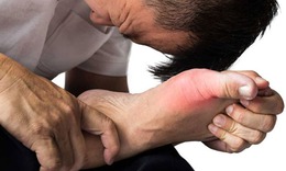Bỏ thịt nhưng vẫn uống bia khiến bệnh gout nặng hơn