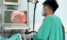 Ngất xỉu tại nhà, cụ ông được phát hiện chảy máu dạ dày nặng