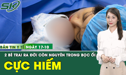 Bản tin Y tế 17/10: Đỡ đẻ thành công cặp song sinh hiếm gặp còn nguyên trong bọc ối