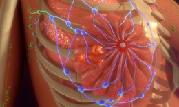 Tìm ra giải pháp tối ưu hóa thuốc điều trị ung thư vú Tamoxifen