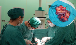 Nam bệnh nhân hoại tử gần 5m ruột non do tắc động mạch hiếm gặp