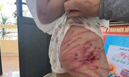 Bạo h&#224;nh trẻ em: Vết thương từ gia đ&#236;nh v&#224; r&#224;o cản ph&#225;p l&#253;