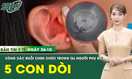 Bản Tin Y Tế 26/10: Xác ruồi cùng 5 con dòi chen chúc trong tai người phụ nữ