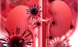 HIV và bệnh thận mạn tính: Những điều nên biết