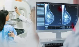 Ph&#225;t hiện sớm ung thư v&#250; nhờ ứng dụng AI trong chụp nhũ ảnh tầm so&#225;t