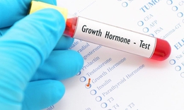 Trẻ thấp l&#249;n do thiếu hụt hormone tăng trưởng