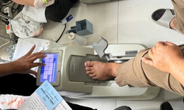 Khoảng 40% người tr&#234;n 70 tuổi c&#243; nguy cơ lo&#227;ng xương