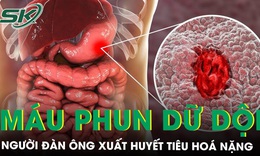 Vỡ tĩnh mạch dạ dày, máu phun dữ dội, người đàn ông thoát chết trong gang tấc nhờ kỹ thuật đặc biệt