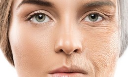 Kem chống nắng - tấm l&#225; chắn chống l&#227;o h&#243;a m&#249;a hanh kh&#244;