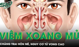 Sổ mũi v&#224;i ng&#224;y, ch&#224;ng trai h&#244;n m&#234;, nguy cơ tử vong cao 