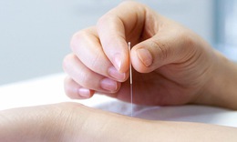 Ch&#226;m cứu điều trị vi&#234;m tuyến tiền liệt: Giải ph&#225;p Đ&#244;ng y giảm đau, ngừa t&#225;i ph&#225;t