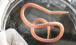 Giun đũa ở người g&#226;y biến chứng nguy hiểm g&#236;, kh&#225;m ở đ&#226;u?