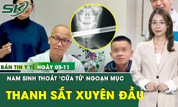 Bản tin Y tế 5/11: Nam sinh tho&#225;t ‘cửa tử’ ngoạn mục sau tai nạn bị thanh sắt đ&#226;m xuy&#234;n đầu