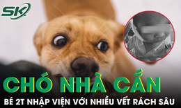 Tưởng ch&#243; nh&#224; v&#244; hại, b&#233; trai 2 tuổi bị cắn r&#225;ch mặt khi đang n&#244; đ&#249;a