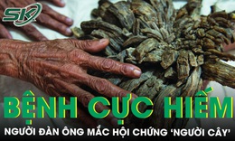 Người đàn ông mắc hội chứng "người cây" cực kỳ hiếm