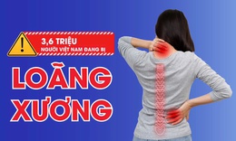 Loãng xương và gãy xương sau 40 tuổi: Nguy cơ âm thầm nhưng có thể phòng ngừa sớm