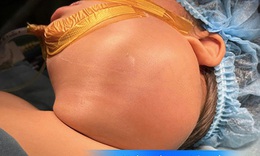 Các biến chứng của u nang bạch huyết ở trẻ em