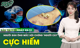 Bản tin Y tế 3/12: Người đ&#224;n &#244;ng mắc bệnh &#39;người c&#226;y’ được phẫu thuật tho&#225;t khỏi u gai sừng 