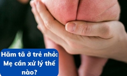 Hăm tã ở trẻ nhỏ: Mẹ cần xử lý thế nào?