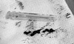 Cụ b&#224; nhiều bệnh nền tho&#225;t chết sau cơn đột quỵ trong nh&#224; vệ sinh