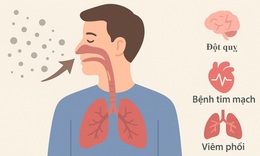 Bụi mịn &quot;đe doạ&quot; phổi v&#224; những người mắc bệnh mạn t&#237;nh như n&#224;o?