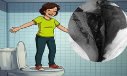 Bồn cầu bất ngờ vỡ khi đứng l&#234;n, b&#233; trai 8 tuổi bị r&#225;ch 25 cm lưng