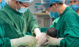 Sản phụ trẻ ở B&#236;nh Dương sinh 2 b&#233; trai sau ca gh&#233;p nối tay đặc biệt