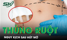 Người phụ nữ thủng ruột nguy kịch sau h&#250;t mỡ