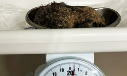 Nửa c&#226;n t&#243;c trong dạ d&#224;y b&#233; g&#225;i 6 tuổi 