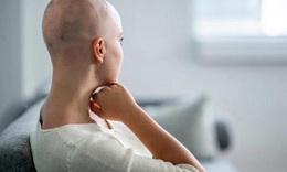 Chăm s&#243;c khi t&#243;c mọc lại ở bệnh nh&#226;n ung thư