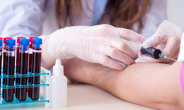 Khi n&#224;o cần l&#224;m x&#233;t nghiệm m&#225;u, yếu tố ảnh hưởng đến kết quả x&#233;t&#160;nghiệm?