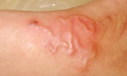Bác sĩ cảnh báo người đang nuôi thú cưng nên biết để phòng mối nguy hại ít ai ngờ