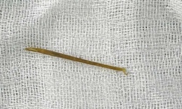 Thủng ruột non do nuốt phải tăm tre