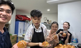 Tái tạo thần kỳ cho những bệnh nhân có gương mặt biến dạng vì bỏng