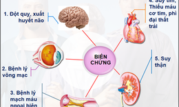 Đồng mắc đ&#225;i th&#225;o đường v&#224; tăng huyết &#225;p, d&#249;ng thuốc như thế n&#224;o?