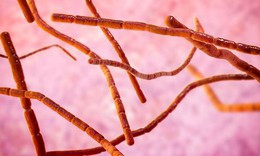 Bệnh do nocardia: Nguy&#234;n nh&#226;n, biểu hiện, c&#225;ch điều trị v&#224; ph&#242;ng bệnh