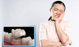 Bọc răng sứ bị đau khi nhai do đâu? Các cách khắc phục