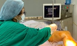 C&#226;u hỏi thường gặp về huyết khối tĩnh mạch s&#226;u